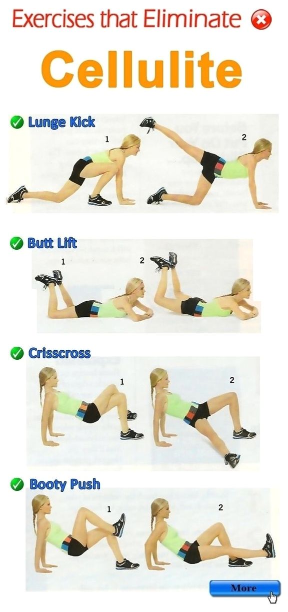 Cellulite workout